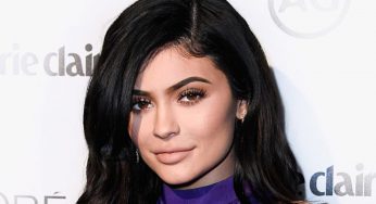 Kylie Jenner prima e dopo: com’era prima del ricorso alla chirurgia? (FOTO)