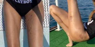 Greta Menchi incidente