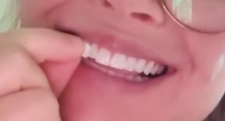 TikTok denti